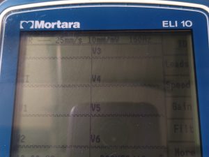 Mortara Instrument, Inc ELI 10 Digital Electrocardiograph