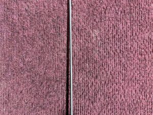 Tulip Medical Liposuction Tool 60cc 3.7mm