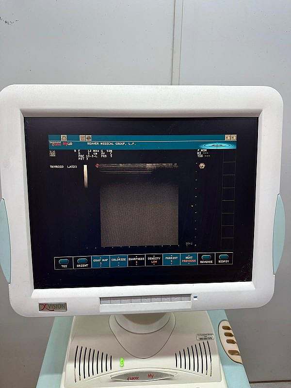 Biosound Esaote MyLab 40 Xvision Ultrasound Machine - Image 3