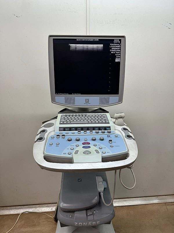 Zonare Z.one Ultrasound Machine