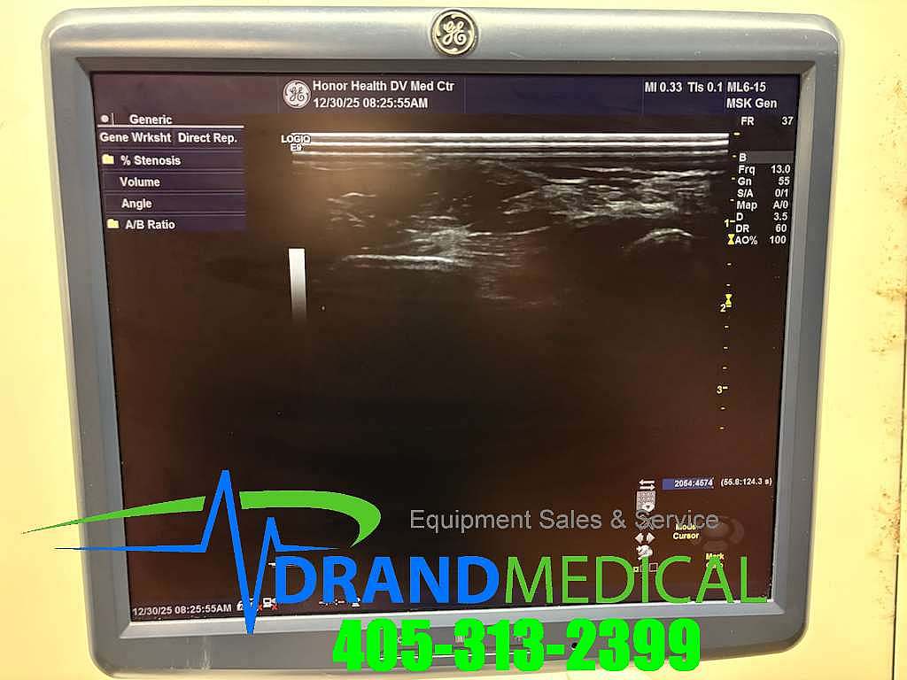 GE LOGIQ E9 ULTRASOUND W/ 4 TRANSDUCER PROBES 2- 9L, 1- ML6-15 and 1- C1-6 - Image 6