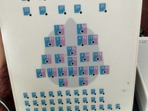 Compumedics E Series EEG/PSG Control Box Module (A1-3)